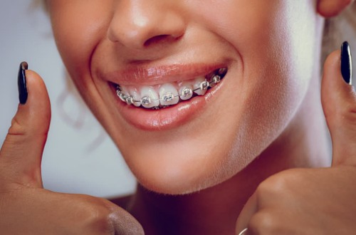 La Clinique 3D orthodontie + Invisalign certifié